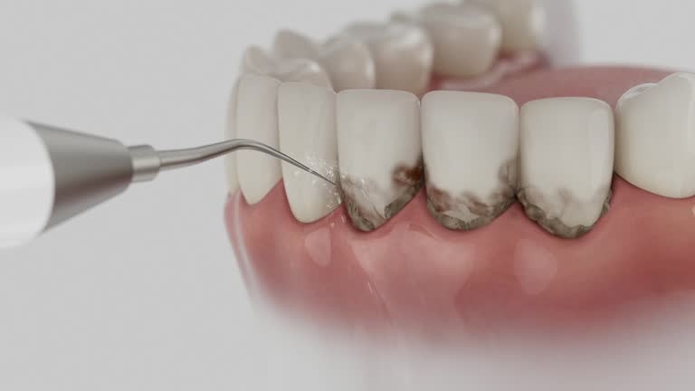 Reliable Dental Implants contractor in Thorndale, PA by Smile Center Dentistry